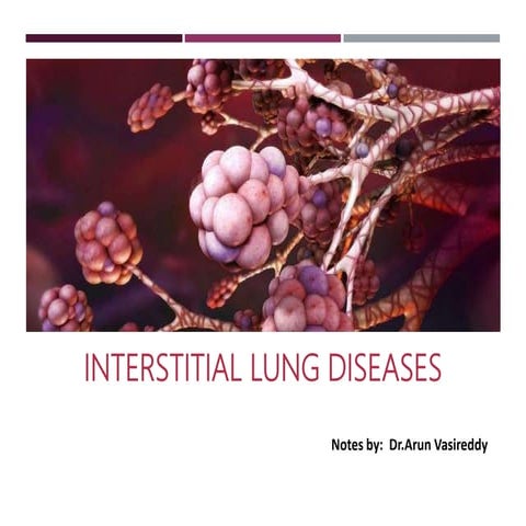 Interstitial lung disease (ILD) ppt slideshare | PPTX