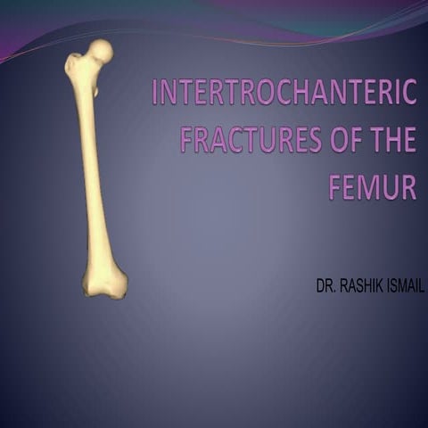 Intertrochanteric fracture femur