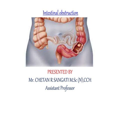 Intestinal Obstruction