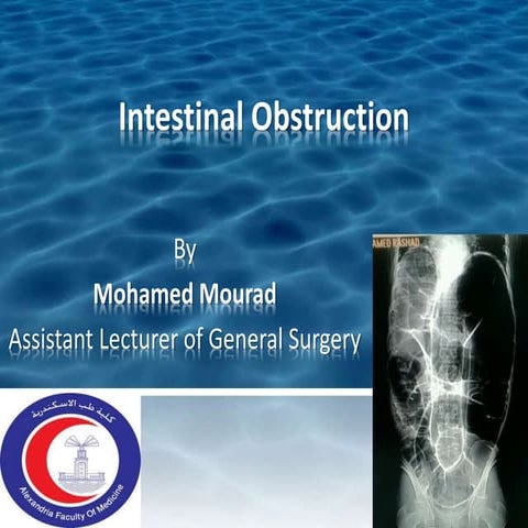 Intestinal obstruction