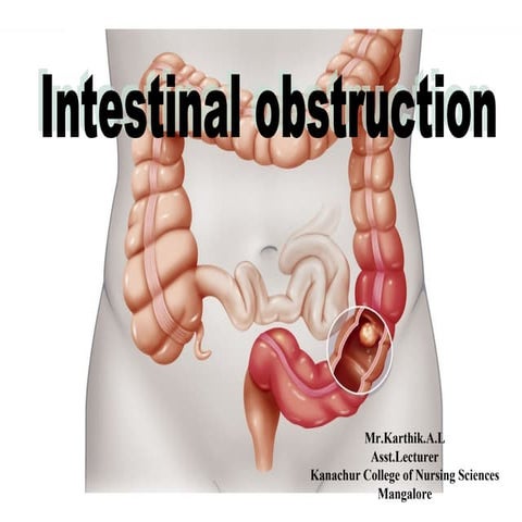 Intestinal obstruction | PPT