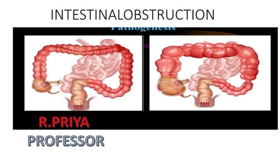 Colonoscopy SSßßsssssssssssssssssssse.pptx