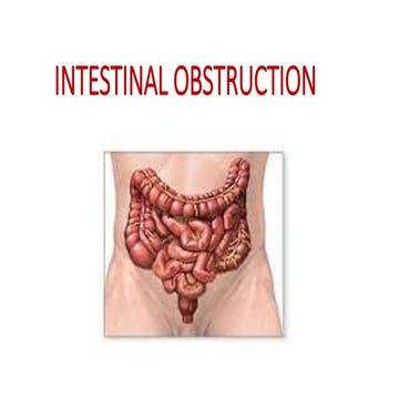 INTESTINAL OBSTRUCTION | PPTX