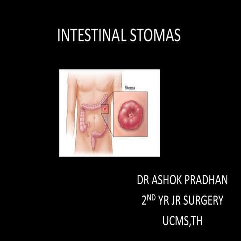 Intestinal stoma( COLOSTOMY)