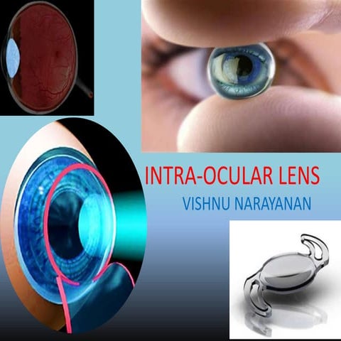Intra ocular lens