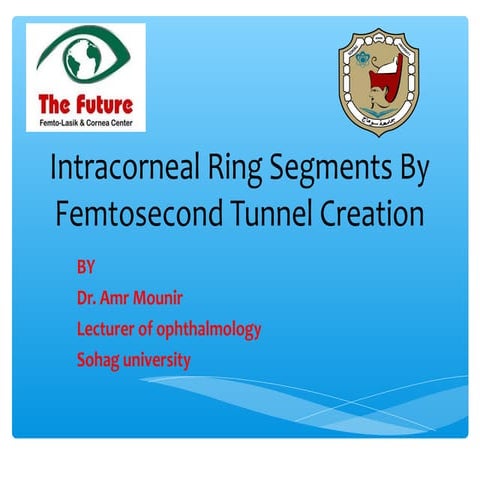Intracorneal ring-segments-by-femtosecond-tunnel-creation | PPT
