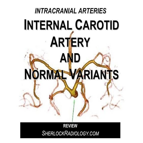 Internal Carotid Artery and Normal Variants