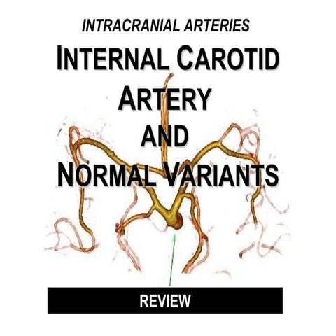 Intracranial arteries
