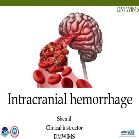 Intracranial hemorrhage,intracerebral Hemorrhage,Brain Bleed 