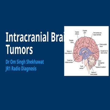 Radiology of Intracranial Tumors  (1).ppt