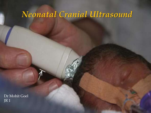 Intracranial ultrasound