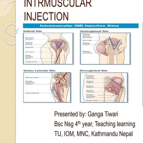 Intramuscular Injection -common sites, procedure, complications
