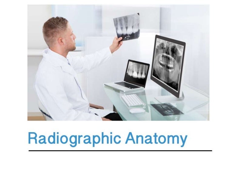 Intraoral radiographic anatomy
