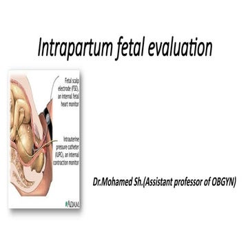 Intrapartum fetal evaluation obstetrics.pptxand gynecological.pptx