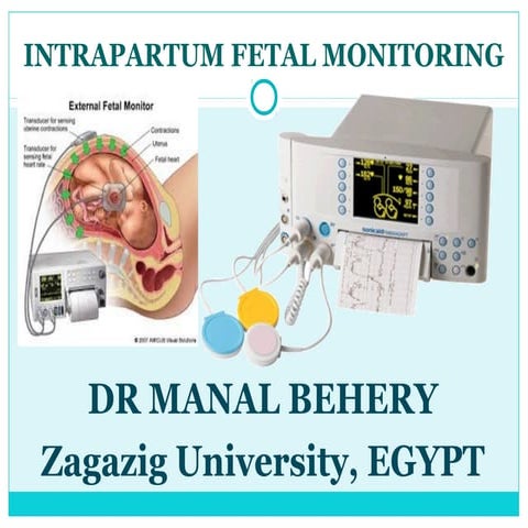 Intrapartum fetal monitoring for undergraduate
