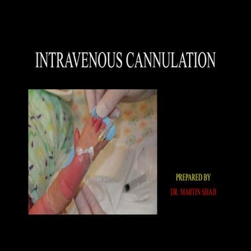 INTRAVENOUS CANNULATION- IN BRIEF 