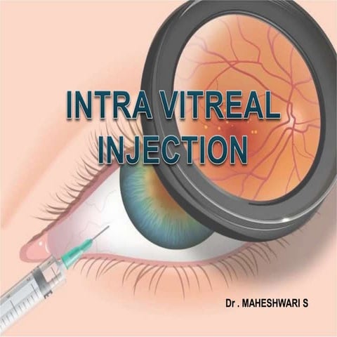 Intravitreal injection | PPT