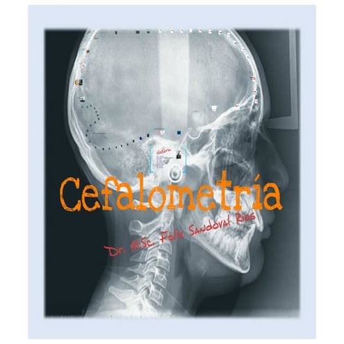 Introduccion a la cefalometria