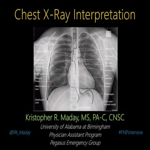 Introduction to Chest X-Ray Interpretation