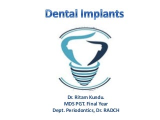 Dazzling White Teeth, All Thanks To Dental Veneers