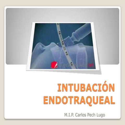 Intubación endotraqueal