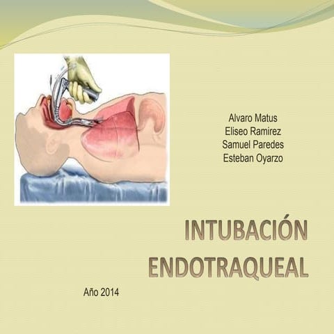 Intubación endotraqueal
