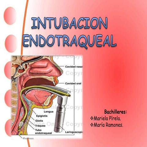 Intubacion Endotraqueal