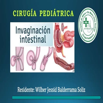 INVAGINACION INTESTINAL PDF COMPLETO.... | PDF