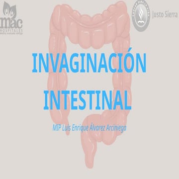 Intuscepcion o invaginacion intestinal | PPTX
