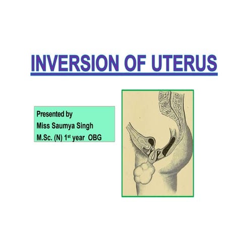 inversionoftheuterus-200523164206.pptx nursing | PPTX