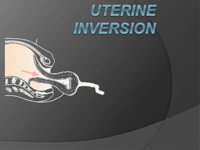 Inversion of the uterus | PPT
