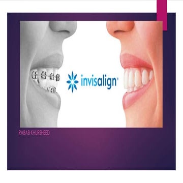Invisalign