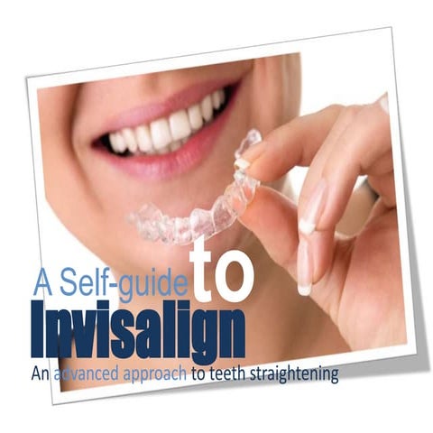All About Invisalign Treatment - Invisalign London | PPTX