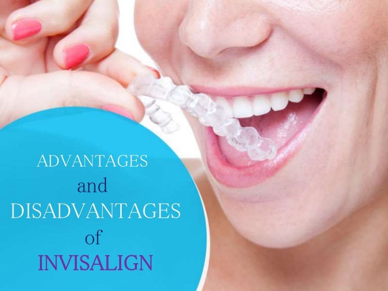 Invisalign Braces Advantages and Disadvantages