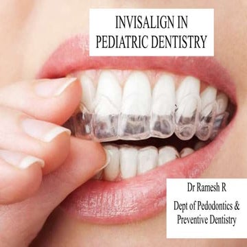 Invisalign in pediatric dentistry