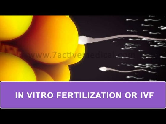 In-Vitro Fertilization | PPTX