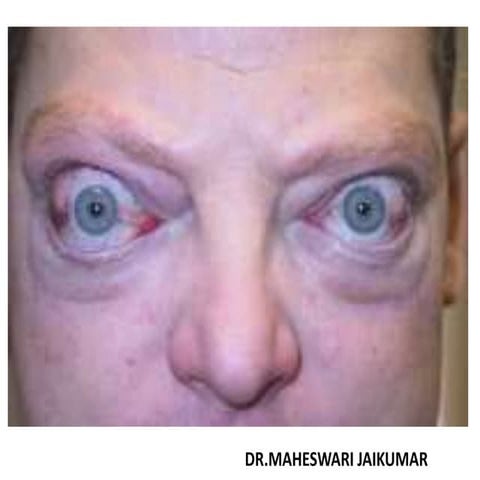 IODINE DEFICIENCY CONTROL PROGRAMME-INDIA