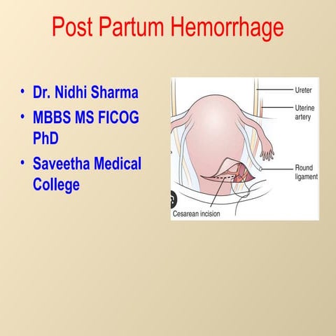 Management of Post-partum hemorrhage (PPH) | PPTX