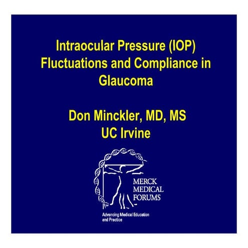 Iop compliance and fluctuations