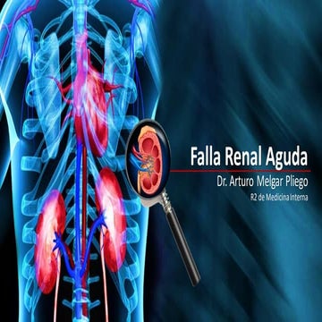 Falla Renal Aguda