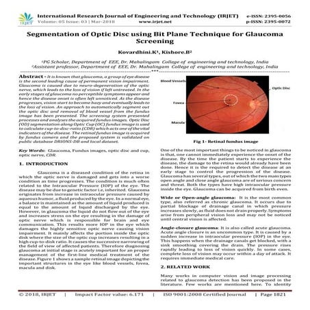 IRJET- Segmentation of Optic Disc using Bit Plane Technique for Glaucoma Scre...