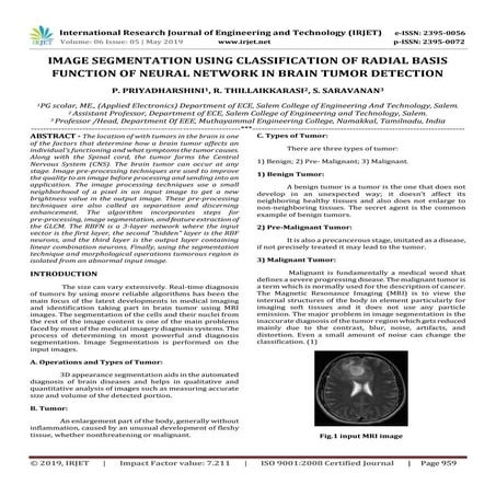 IRJET- Image Segmentation using Classification of Radial Basis Function of Ne...