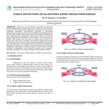 IRJET- Early Detection of Glaucoma using Image Processing