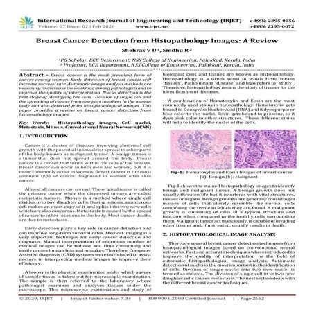 IRJET-  	  Breast Cancer Detection from Histopathology Images: A Review