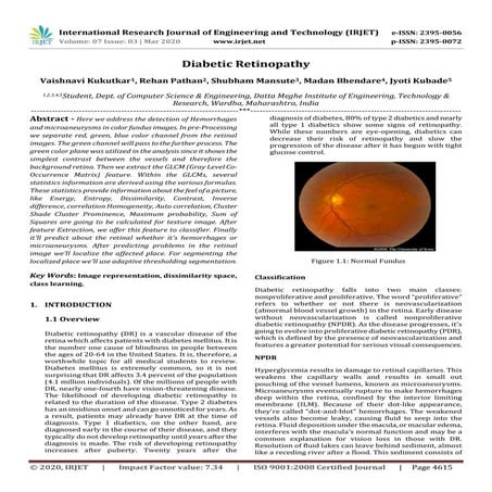 IRJET - Diabetic Retinopathy