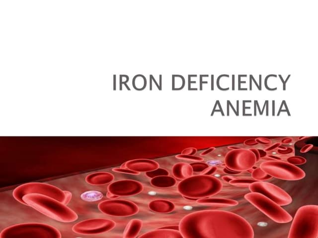 Iron deficiency anemia PPTX Blood Disorders Diseases and Conditions Iron deficiency anemia PPTX Blood Disorders Diseases and Conditions