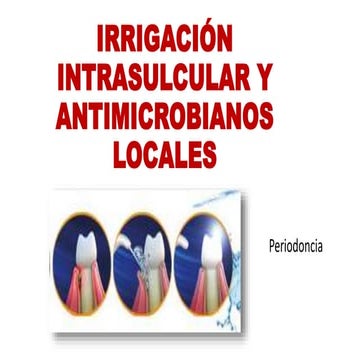 Irrigacion intrasulcular y antibioticos locales en periodoncia