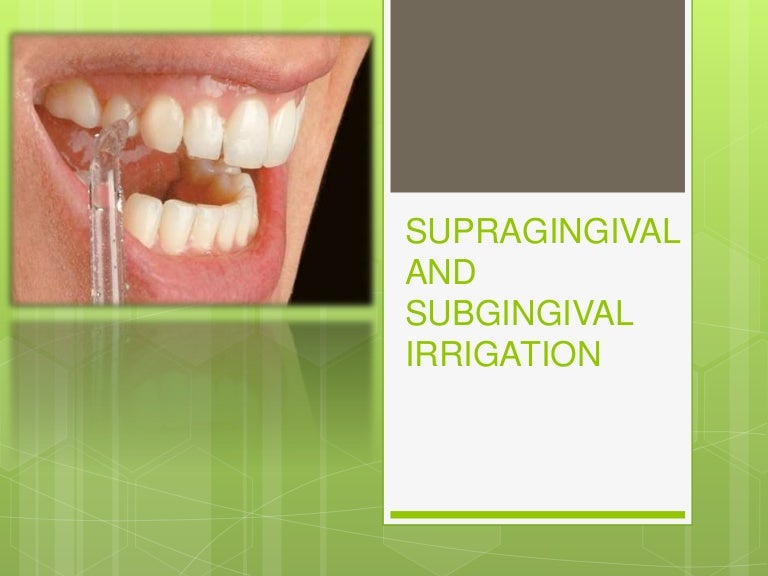 SUPRAGINGIVAL AND SUBGINGIVAL IRRIGATION