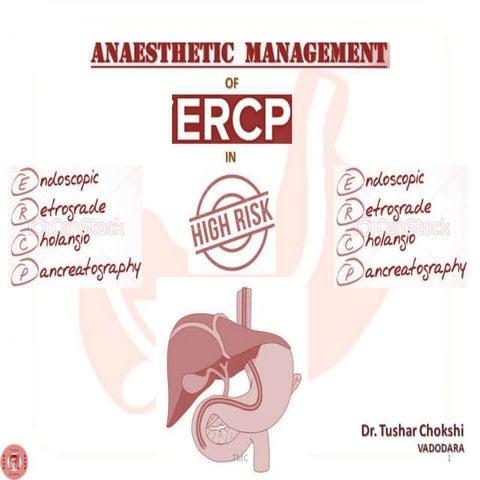 Anesthetic management of ERCP patient tushar chokshi