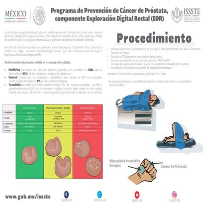 ISSSTE tríptico hiperplasia prostática | PDF
